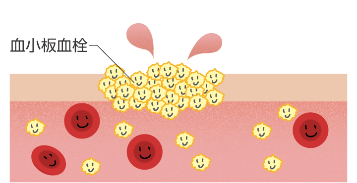 血友病患者の今後の見通しはどのようなものですか?